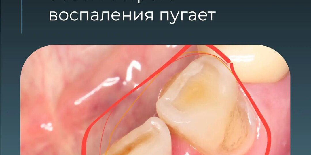 Этим зубам не оставляли шанса