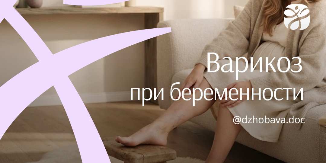 Варикоз при беременности: почему это не просто «сеточка на ногах»?