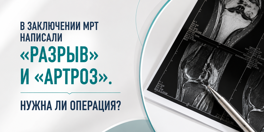В заключении МРТ написали «разрыв» и «артроз». Нужна ли операция?