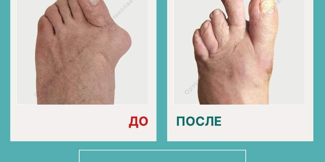 84 года