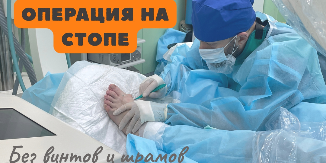 Избавляемся от косточки без винтов и шрамов