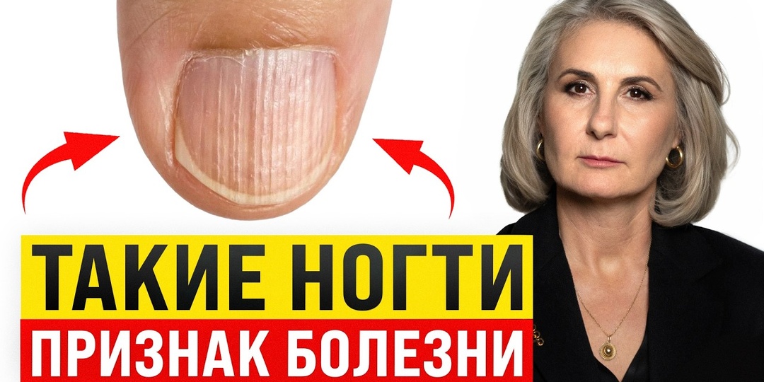 Последние исследования: о каких проблемах организма могут рассказать ногти