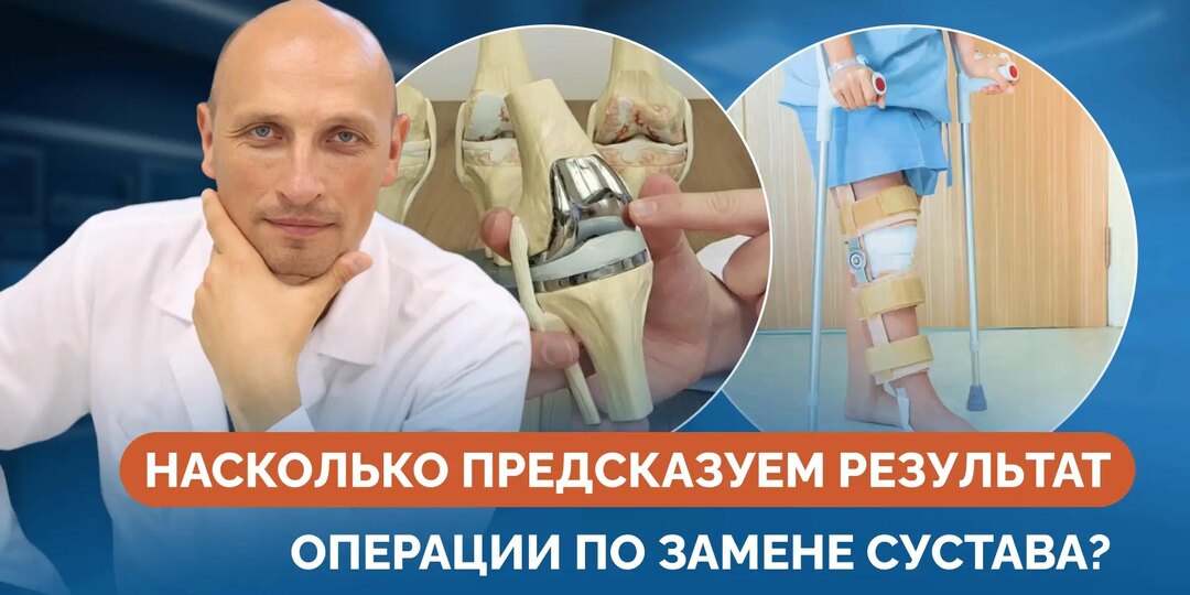 Насколько предсказуем результат операции по замене сустава?