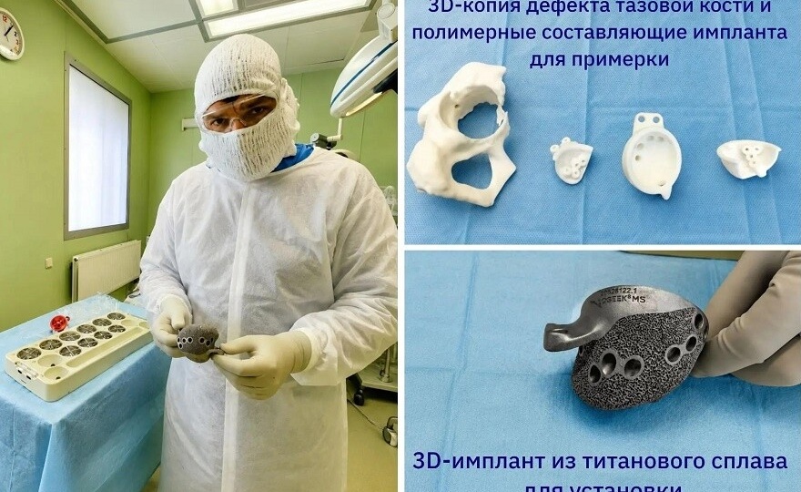 Сургутские травматологи-ортопеды наращивают применение 3D-печатных имплантатов