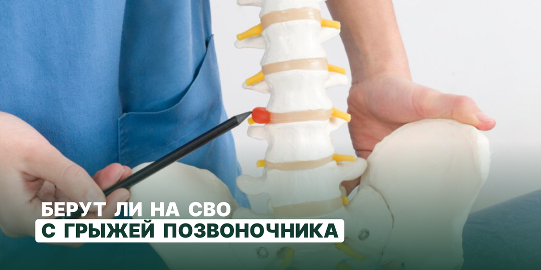 Берут ли на СВО с грыжей позвоночника: категории годности и требования ВВК