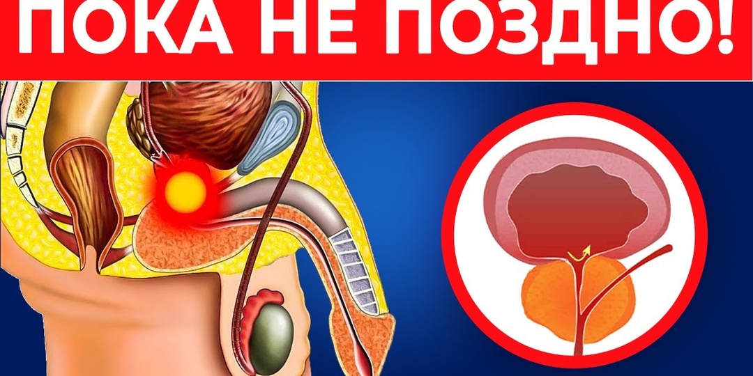 Последние исследования о простате: какой симптом мужчины часто считают обычным возрастным изменением