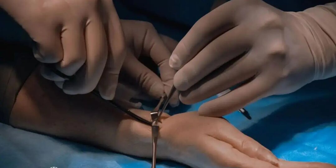 Болезнь де Кервена: почему болит запястье и как это лечить