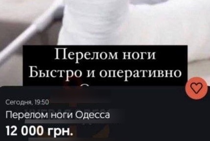 В Одессе предлагают сломать ногу за 12 тысяч гривен ради отсрочки от мобилизации