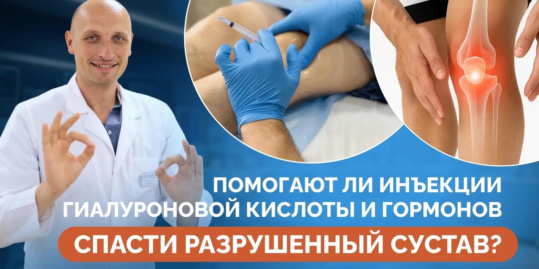 Помогают ли инъекции гиалуроновой кислоты и гормонов спасти разрушенный сустав?