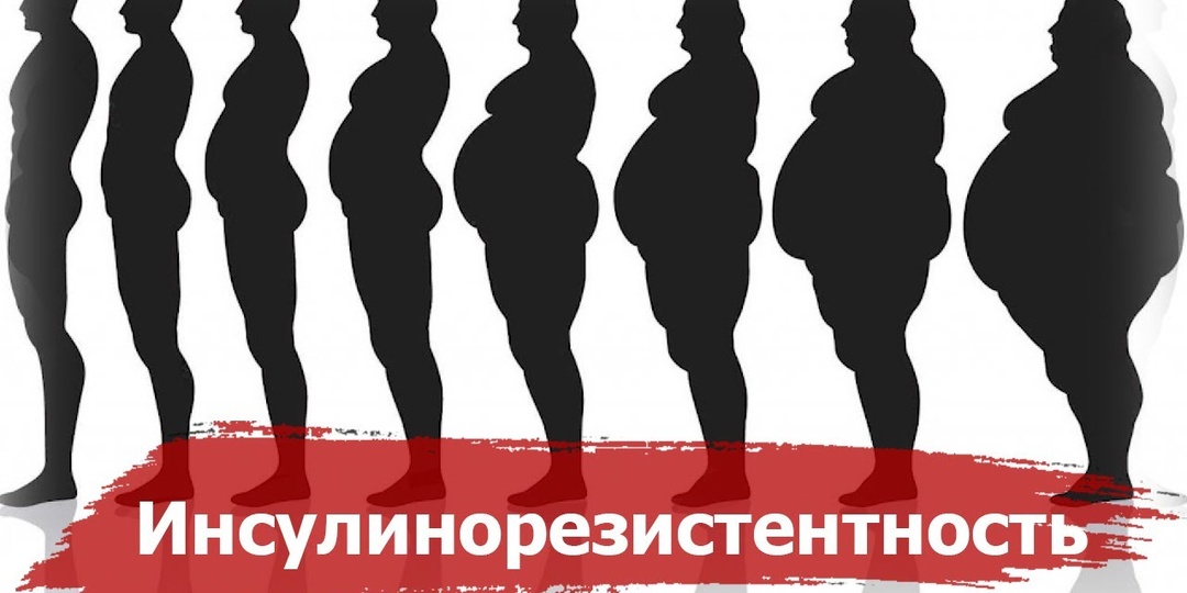Инсулинорезистентность: что это такое и почему об этом стоит знать каждому