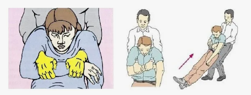 ПРИЁМ РАУТЕКА