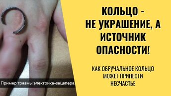 Непростое украшенье. Почему электрики не носят кольца на работе