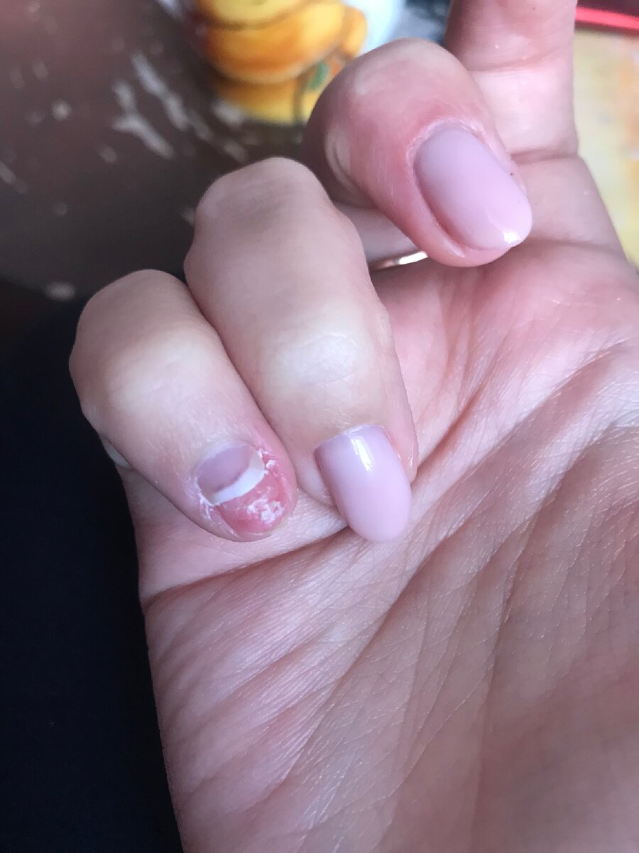 Или хуже того, оторвать его полностью