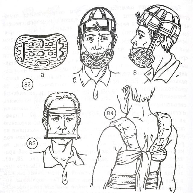 Примеры иммобилизующих повязок. Источник: А.П. Юрихин "Десмургия"