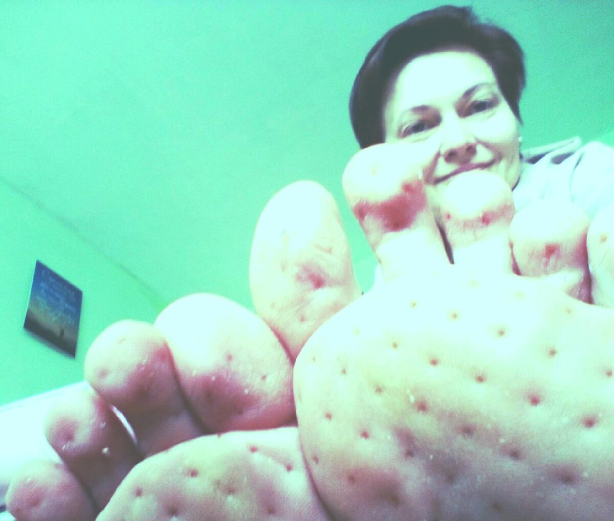 На ногах следы гвоздей: да, имеет место быть воздействие гвоздей вглубь тканей стоп, но никаких проколов нет!!!