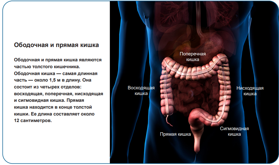 Метастазы при колоректальном раке. Колоректальная карцинома. Среднеампулярный отдел прямой кишки. Макроскопические варианты колоректальных карцином.