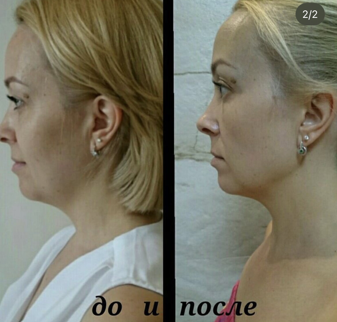 -2