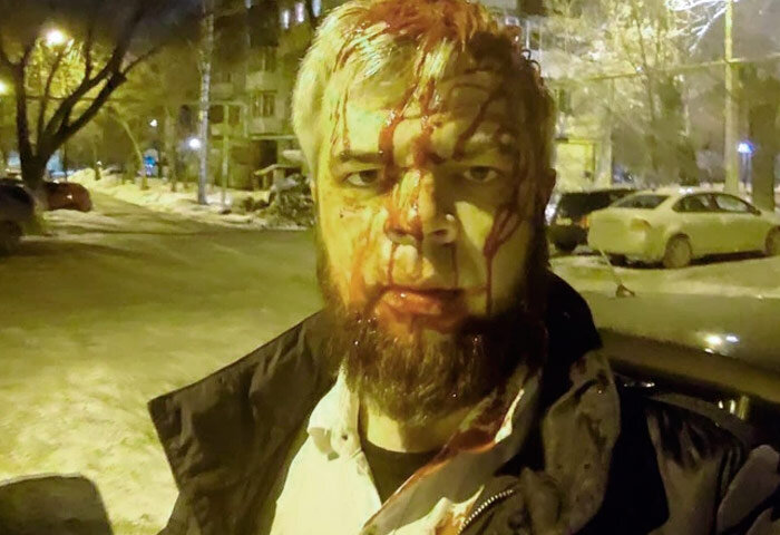 В Челябинске избили адвоката Кошмана у подъезда его дома (фото: 74.RU)