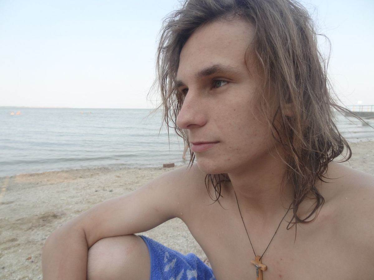 Несмотря на подростковое проблемы с лицом. как можно видеть - с кожей на теле у меня все нормально. Тут мне 15 лет и дерматит почти не проявляется