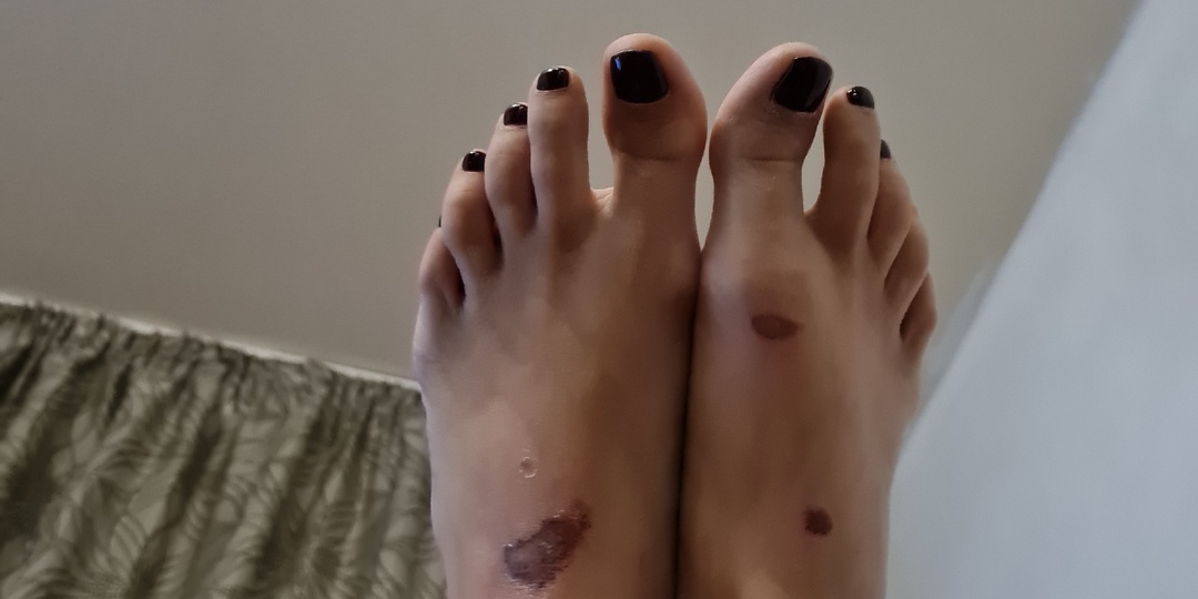 Новый год и его последствия.