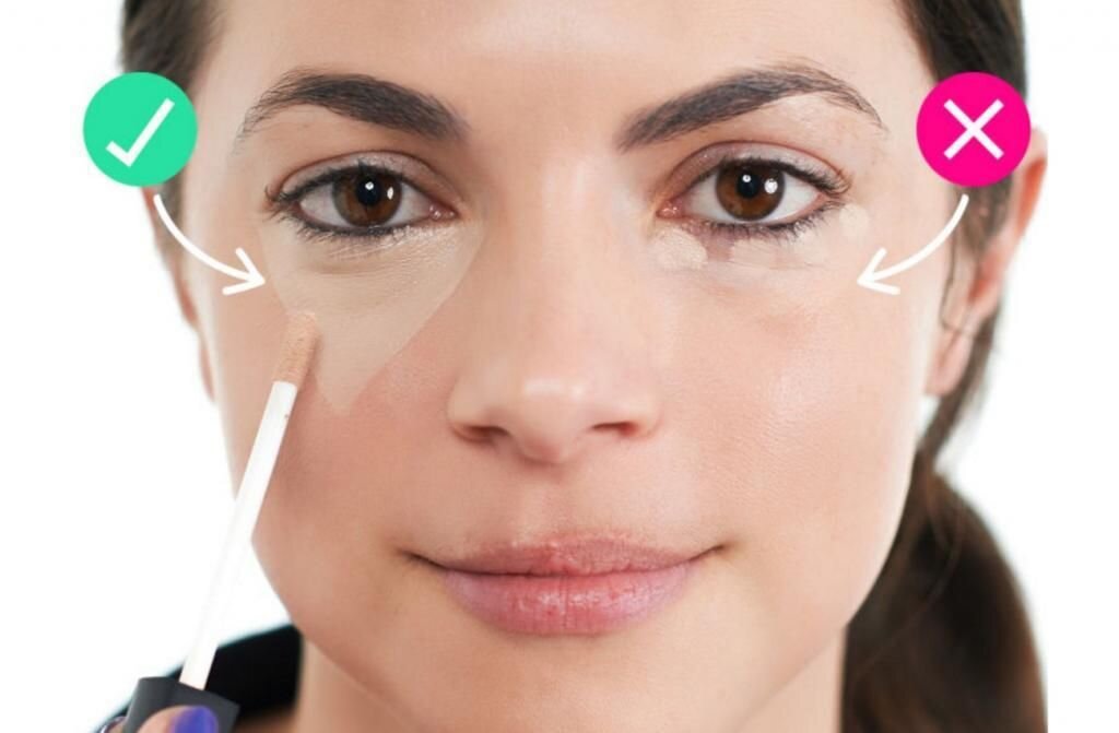 Консилер необходимо наносить треугольником, как изображено на фото выше. Фото взято из открытых источников.