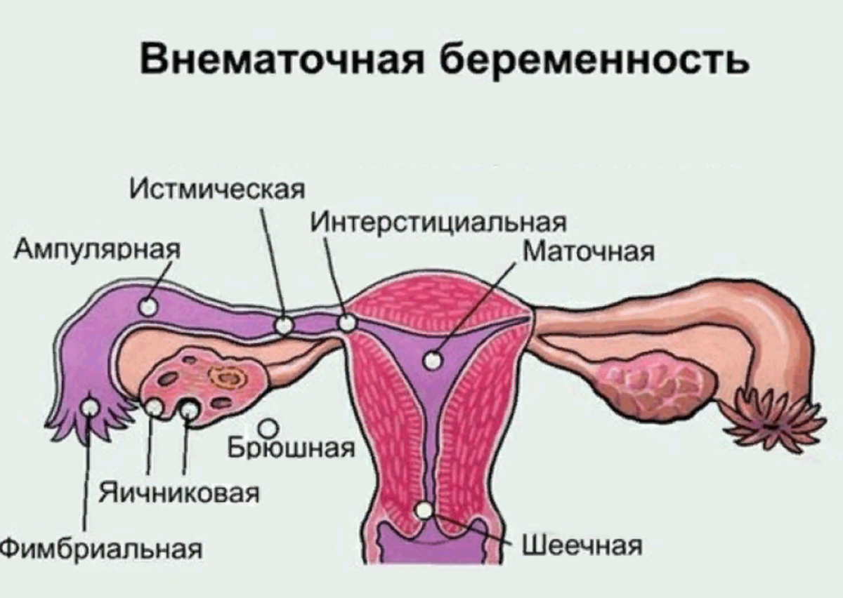 Где расположены маточные трубы у женщины картинки