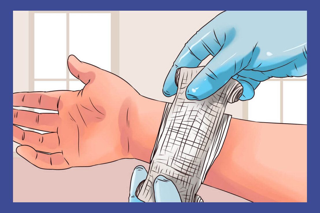 Микроповреждения 