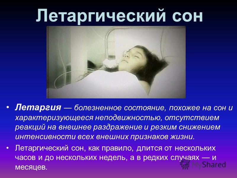 Сколько людей умирает во сне. Презентация на тему летаргический сон. Летаргия интересные факты. Летаргический сон и кома.
