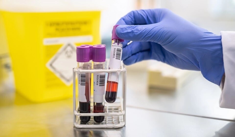 Анализы, которые нужно сдавать каждый год.