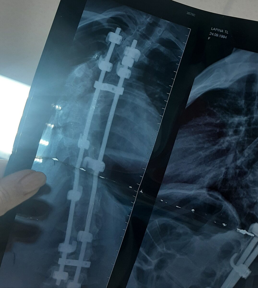 Вот так сейчас выглядит мой снимок