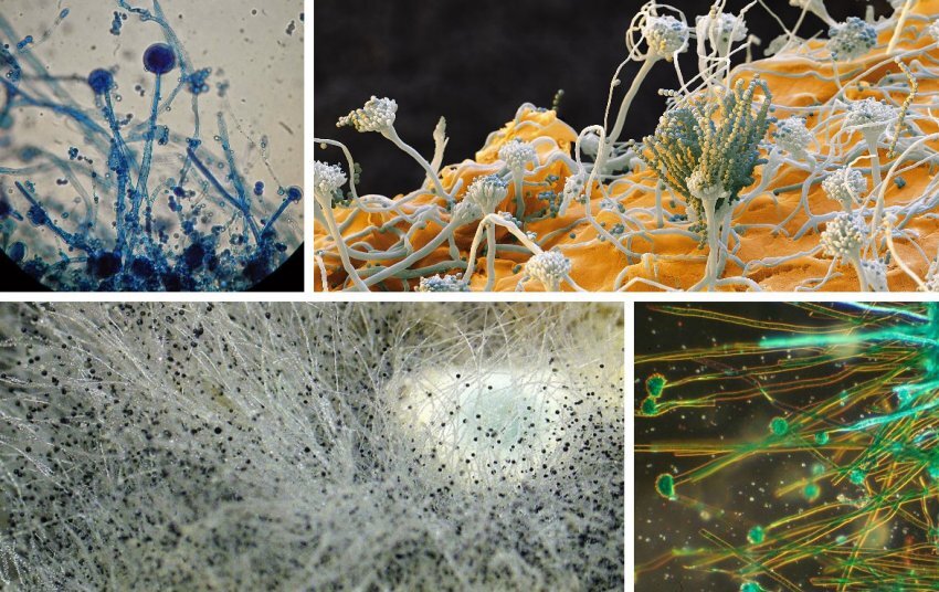 Плесень под микроскопом.