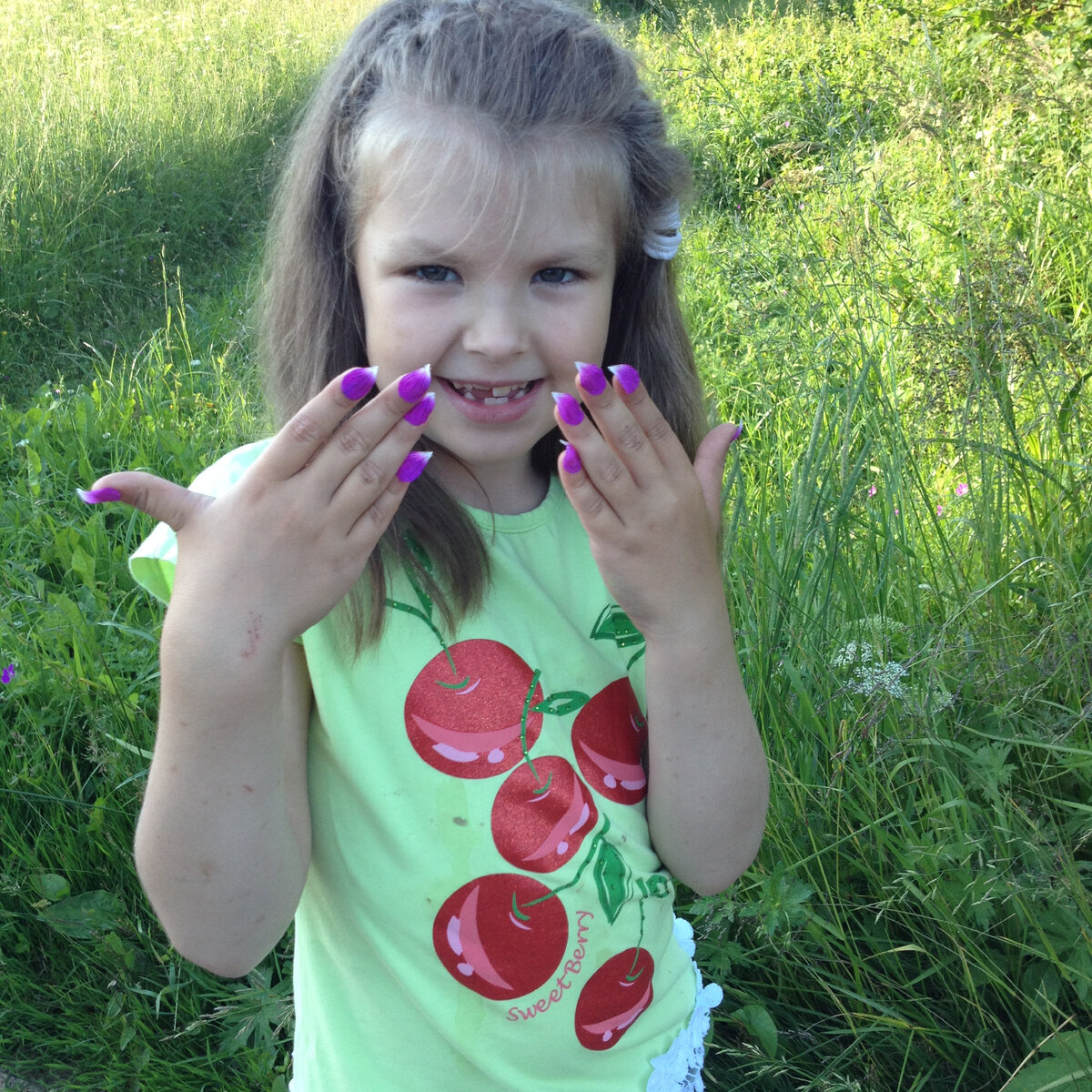 На фото зуб только начал расти