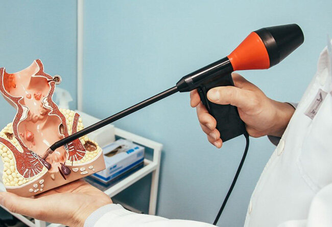 Удаление бахромок | Клиника Кожухово | Дзен