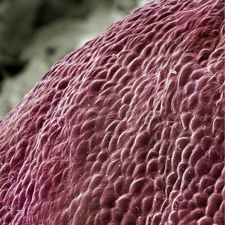 Кожа микроскоп. Кожа микроскоп. Микрос под. Роговой слой эпидермиса под микроскопом. Кожа микроскоп.