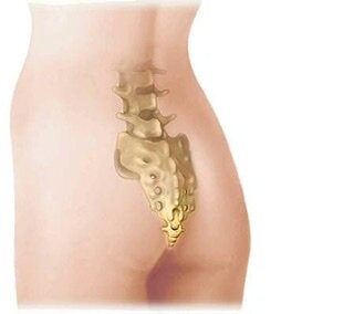 💬Обычно мы не вспоминаем про существование такой маленькой косточки в нашем организме под названием копчик. Пока она не становится источником боли…
💬Копчик состоит из 3-5 спаянных друг с другом рудиментарных позвонков. Он служит местом прикрепления связок и нескольких мышц, в том числе большой ягодичной и мышцы, поднимающей задний проход (levator ani). Когда мы сидим, отклонившись назад, то помимо седалищных бугров опираемся на копчик.
💬Болевой синдром, связанный с копчиком, называется кокцигодинией.
✔️Кокцигодинией в 5 раз чаще страдают женщины из-за особенностей строения таза и травмах копчика в родах.
✔️Помимо женского пола фактором риска является ожирение.
💬Этиология.
✔️Травма (чаще всего падение назад), в результате которой копчик оказывается ушиблен, сломан, вывихнут.
✔️Повторяющиеся незначительные травмы, которым подвержены многие из нас - длительное сидение, особенно в неправильном положении и на твёрдой, узкой или просто неудобной и плохо приспособленной поверхности (в том числе длительные поездки в машине, долгие перелёты, велопрогулки).
✔️Травма во время родов.
✔️Особенности строения копчика.Костные шипы (спикулы). Нестабильность копчика - гиперподвижность или, наоборот, гипоподвижность крестцово-копчикового сустава.
✔️Остеоартрит и дегенеративные изменения в крестцово-копчиковом сочленении. 
✔️Редкие причины (инфекция, метастатический рак, хордомы и т.д.).
✔️Иногда причины болей в копчике остаются скрыты от нас, тогда кокцигодиния называется идиопатической.
💬Типичные жалобы:
✔️боль в копчике в положении сидя, особенно если отклониться назад;
✔️усиление боли при вставании;
✔️боль при дефекации, половом акте;
✔️возможна иррадиация боли в тазовое дно.
💬В большинстве случаев клиническая картина настолько характерная, что диагноз может быть поставлен на основании жалобы и осмотра пациента, без дополнительных методов визуализации.
💬Обследование потребуется:
✔️если была тупая травма, за которой последовала сильная боль, то есть при необходимость исключить перелом или смещение копчика (назначают рентгенографию в двух проекциях);
✔️если есть симптомы, наводящие на мысли о гнойно-воспалительных процессах или злокачественные заболевания: лихорадка, ознобы, ночная потливость, необъяснимая потеря веса, ректальное кровотечение, боль, локализованная не в копчике (может быть рекомендована МРТ малого таза);
✔️если симптомы сохраняются более 2 месяцев.
💬Для диагностики кокцигодинии помимо уже упомянутых рентгенографии в двух проекциях и МРТ малого таза рекомендуют динамическое рентгенологическое исследование. Оно позволяет выявить гипермобильность копчика. Рентгенограммы делают в боковой проекции в положении стоя и сидя. Естественно, положение копчика в положении сидя меняется. Нормальной считается подвижность в пределах 2-25 градусов. Однако на практике подобное исследование мало где выполняется.        
💬90% кокцигодиний проходит или самостоятельно, или на фоне лечения. Начинают с простых и неинвазивных мер.  
✔️Избегать опоры на копчик. В положении сидя опираться на седалищные бугры, то есть сидеть прямо или чуть наклонившись вперёд. Использовать подушку клиновидной формы, то есть с вырезом сзади, под копчиком. Подушка в виде пончика не подойдёт. 
✔️НПВС. Исключение: острый перелом (возможно ухудшают заживление). 
✔️Холод или тепло (равноэффективны).
💬Если симптомы сохраняются более 2 месяцев можно перейти к плану Б.
✔️Топическое введение анестетиков или их комбинации с кортикостероидами в область крестцово-копчикового сустава, межкопчиковых сочленений. Блокада непарного ганглия (симпатический нервный узел, лежащий кпереди от верхней половины копчика) под рентген-контролем.
💬Некоторым пациентам с упорной кокцигодинией допустимы варианты лечения, данные об эффективности которых неоднозначны. А что делать, когда болевой синдром стоек. В их числе pelvic floor physical therapy (по смыслу напоминает мануальную терапию) для борьбы с миофасциальным синдромом, массаж мышц, прикрепляющихся к копчику, препараты обычные для борьбы с хронической болью, нейростимуляция.
💬И только когда совсем ничего не помогло, от копчика избавляются хирургически.
