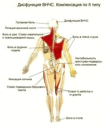 Вот Вам пример, как один спазм далее перекашивает всё тело. Источник: httppsyolia.comanatomiya-vnchs