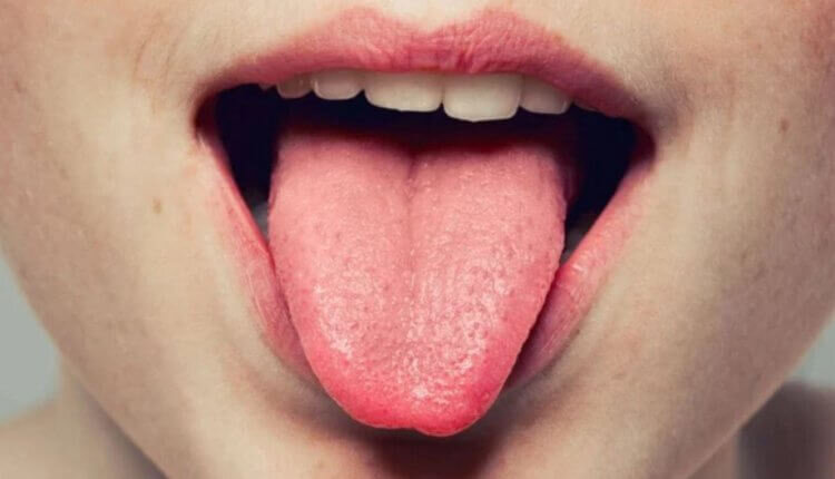 Металлический привкус во рту — это не так страшно, как кажется 