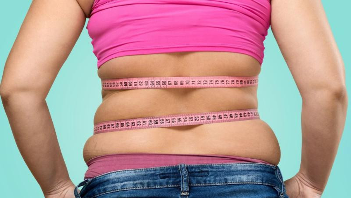 жировая складка на спине