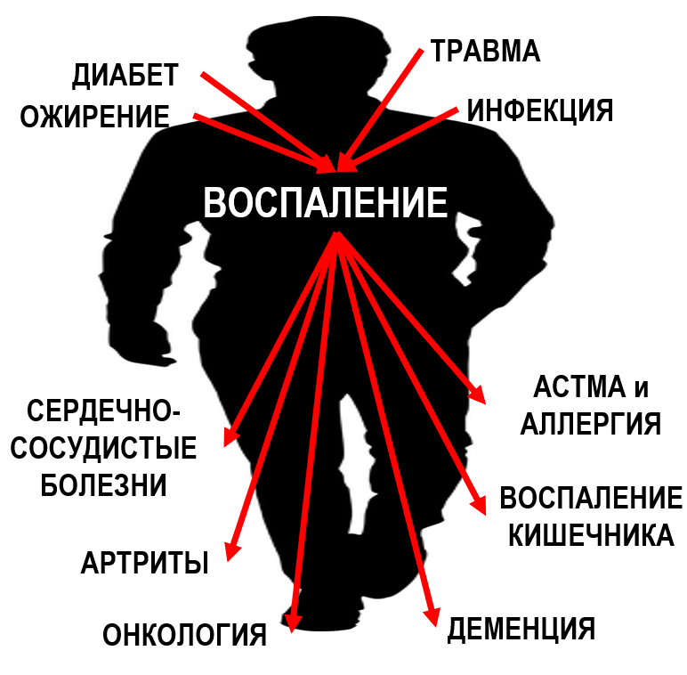 Можно ли лечить артроз в домашних условиях?