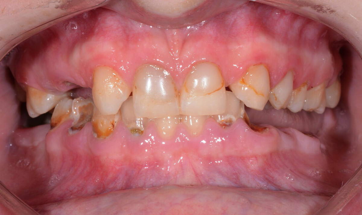 Исходник с которым пришла пациентка.