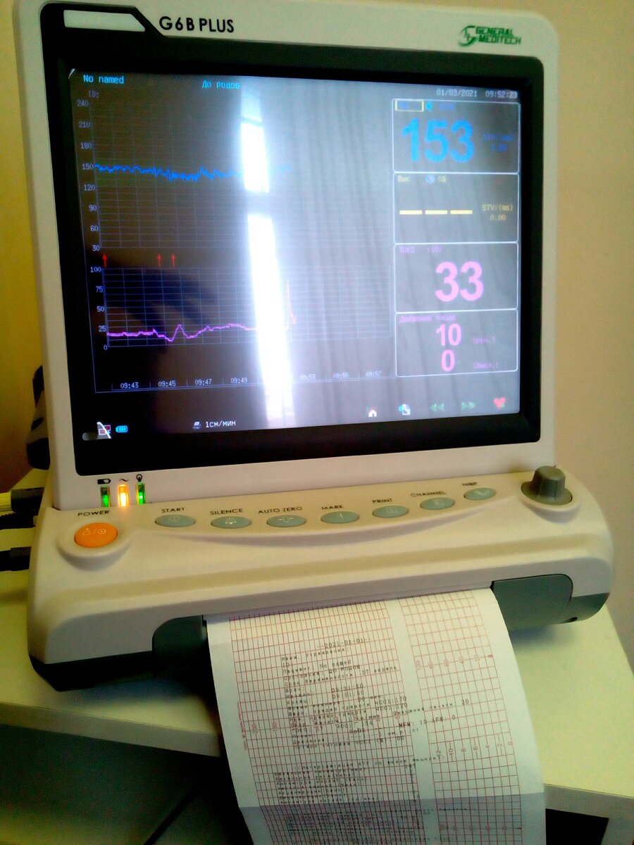 Личное фото.