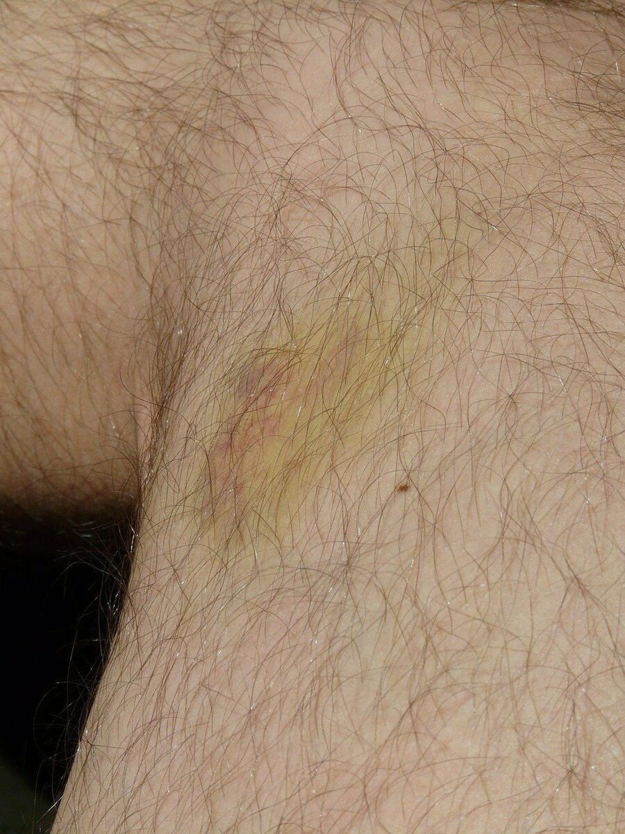 Фото pixabay.com