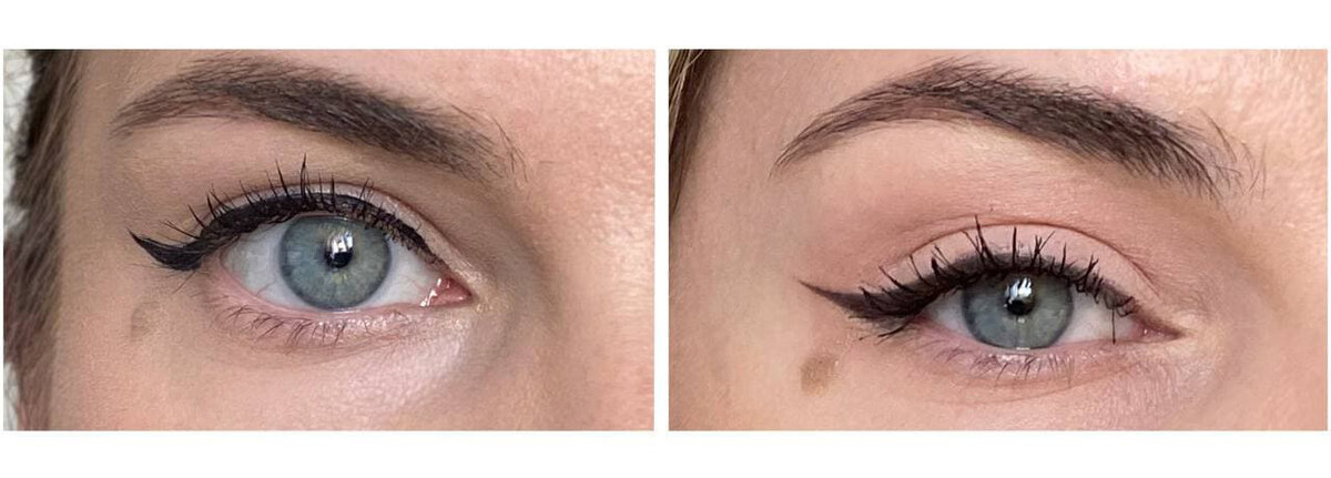 Слева - округлая направляющая. Справа - ровная прямая направляющая. Листай->