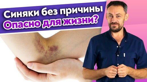 Как быстро убрать гематому? Синяки и гематомы на теле.