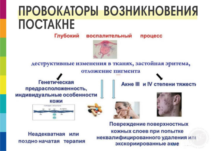 Подробная схема основных причин развития постакне