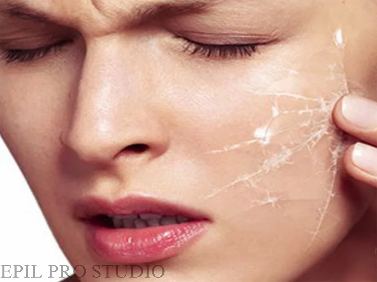 обезвоженная кожа