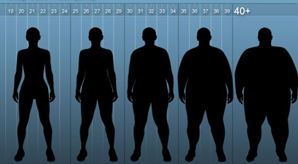 Степени ожирения. 1 Стадия ожирения. Ожирение первой степени. Ожирение по степеням.