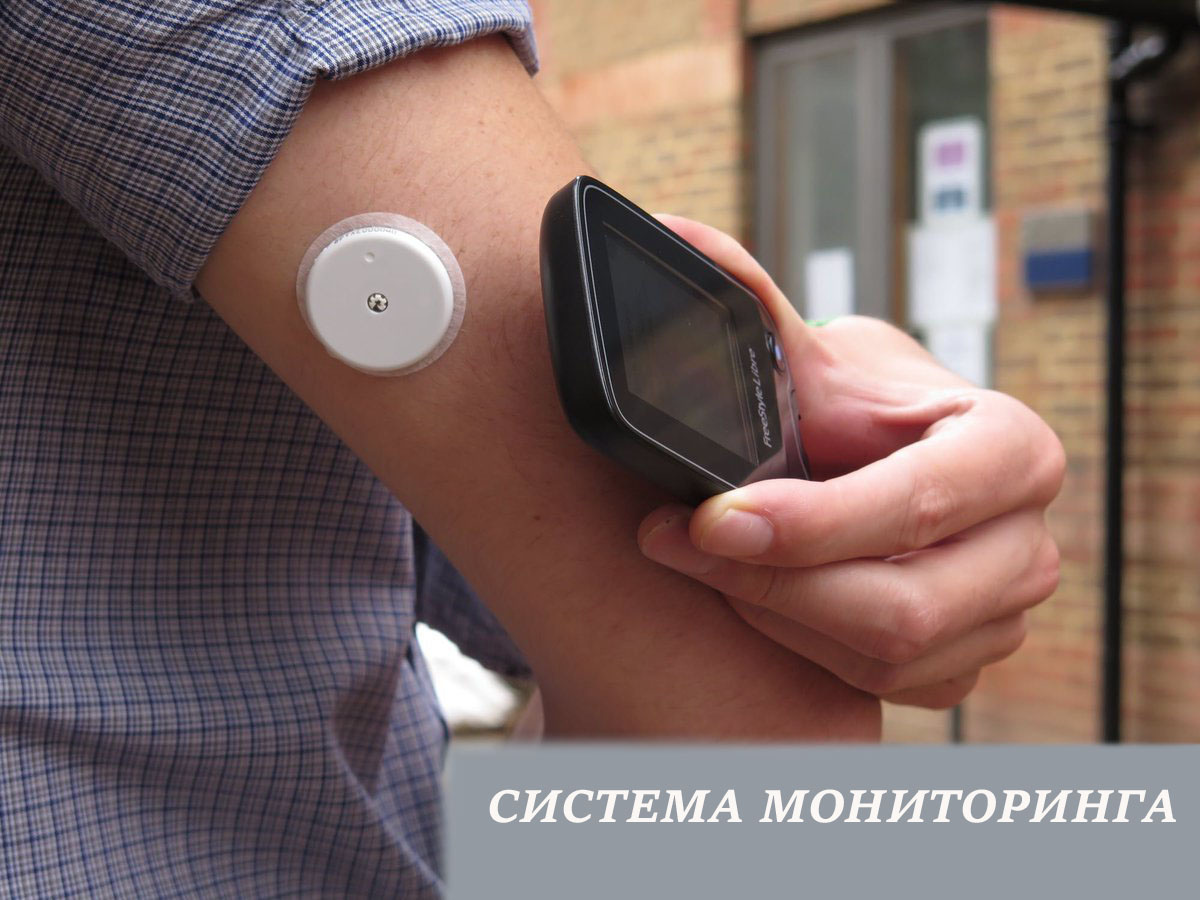 Система непрерывного мониторинга глюкозы.