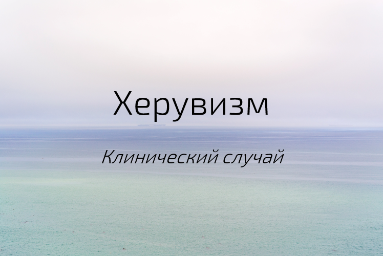 Photo by Sergei A on Unsplash 