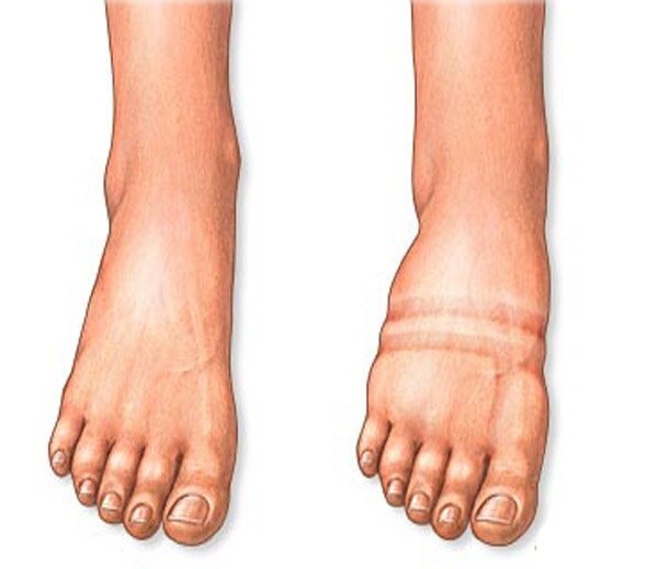 Фото источник narrecepti.ru